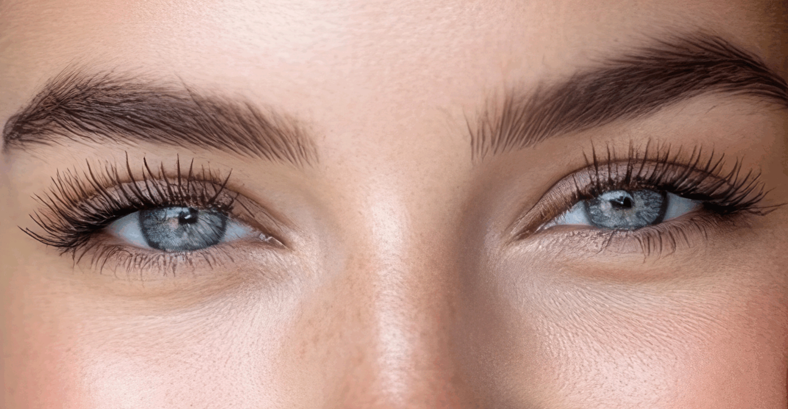 Blefaroplastia 1 1 scaled