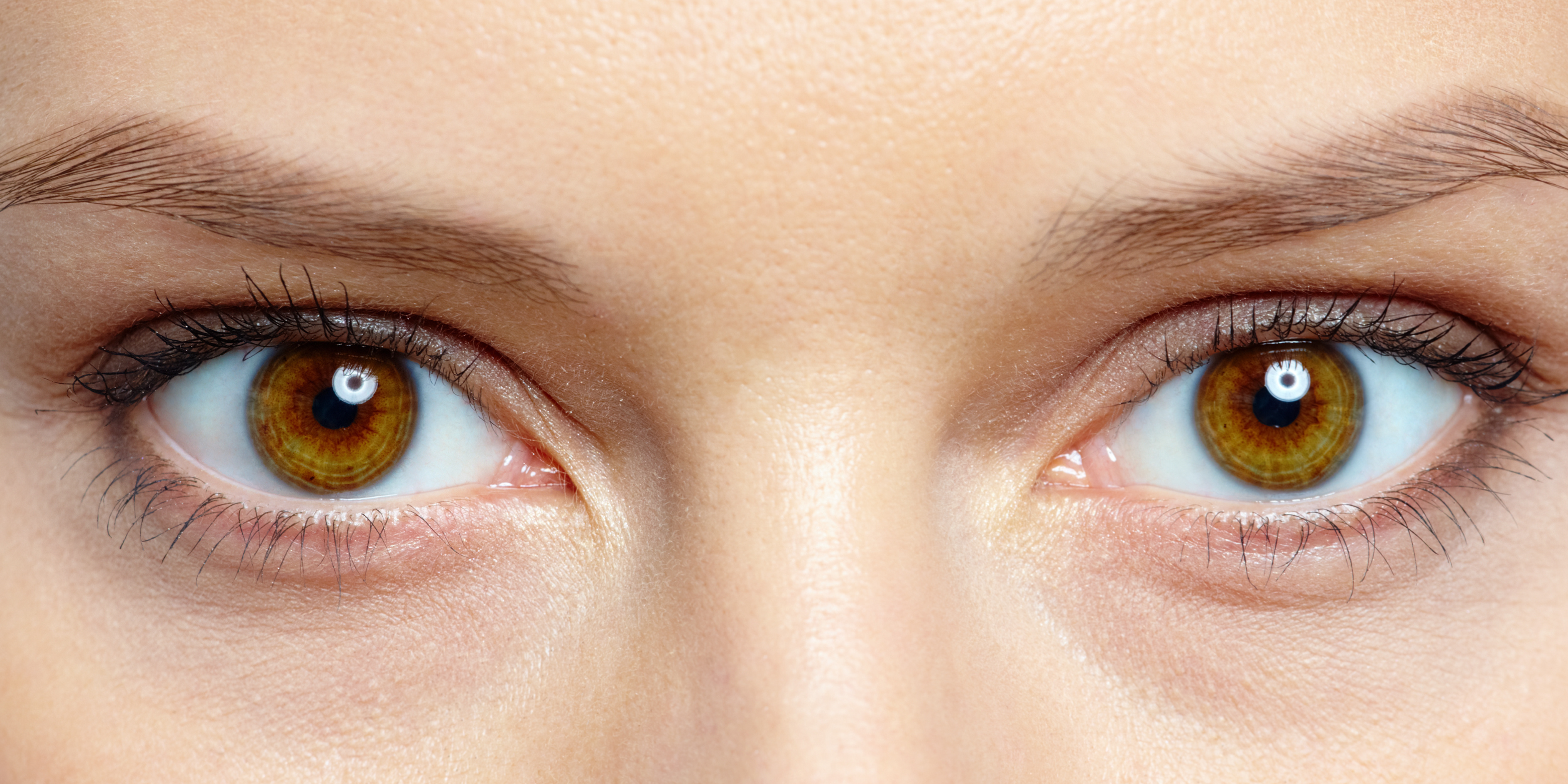 Blefaroplastia en Madrid 7 2