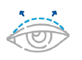 Blefaroplastia Diseno REJUVENECE TU MIRADARecurso